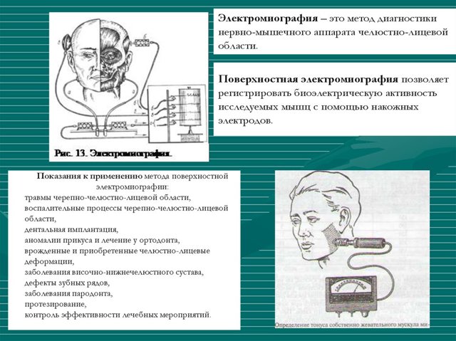 Электронейромиография: виды методики, подготовка, обследование