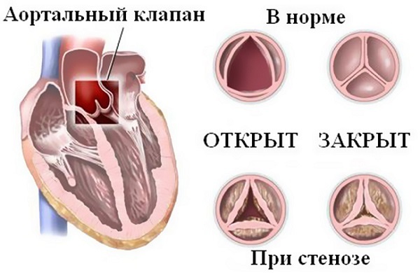 Симптомы при болях в сердце - характеристика, признаки,помощь