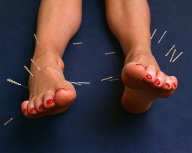 Можно ли вены на ногах убрать без операции, методы, профилактика