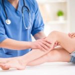 Варикозные узлы на ногах - причины, опасность, методы лечения