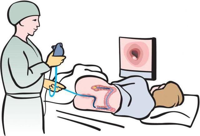 Колоноскопия при варикозе кишечника - назначение, плюсы, минусы