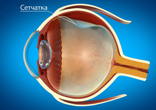 Эмболия сетчатки глаза - симптомы, диагностика, лечение