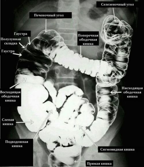 Аноскопия при варикозе кишечника - что за процедура, как проводится