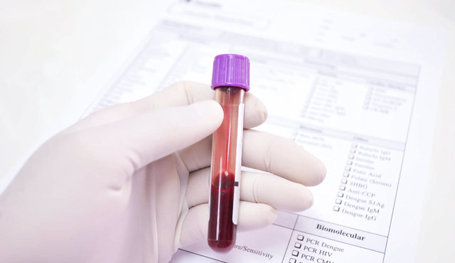 Гликированный гемоглобин: норма и метод диагностики - нормы