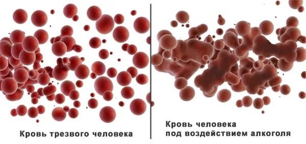 Алкоголь при тромбозе, можно или нет, как действует на кровь, за и против
