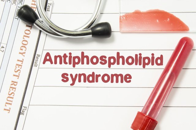 Антифосфолипидный синдром - причины, симптомы, лечение