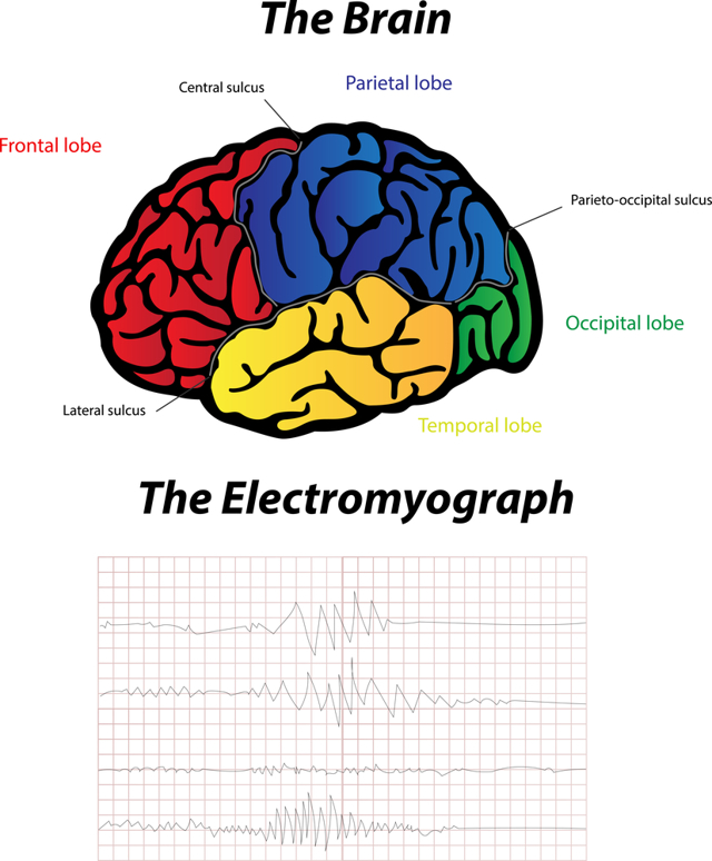 Электронейромиография: виды методики, подготовка, обследование