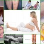 Тромбоз при беременности, причины, симптомы, риски, как рожать