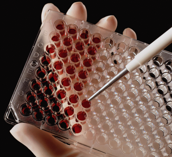 Биохимический анализ крови - показания, расшифровка, нормы